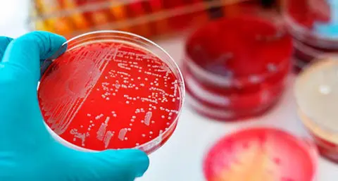 superbacterias-1