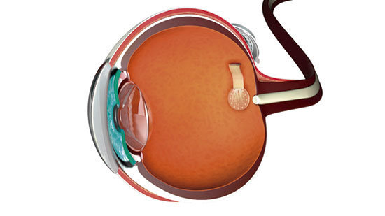 Desarrollan-protesis-de-retina-basadas-en-grafeno_image_380
