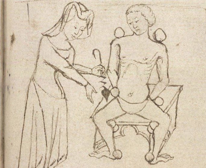Una mujer utilizando instrumental quirúrgico. Detalle del manuscrito Sloane 6. John of Arderne, Medical treatise. Inglaterra, 2º cuarto del siglo XV.