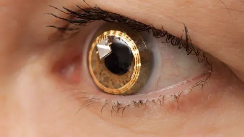 Presentamos-las-lentillas-inteligentes-que-suministran-medicamentos-b (1)