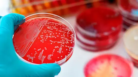 superbacterias-1