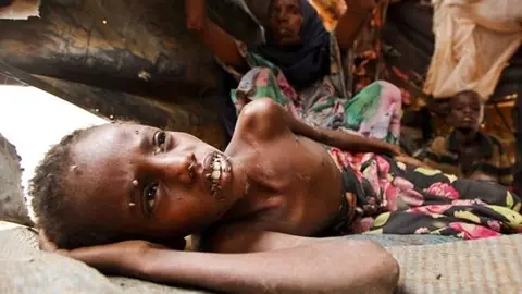 ETIOPIA