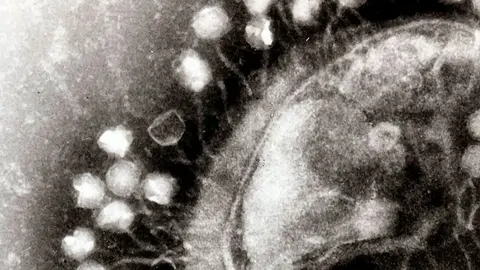 virus-1