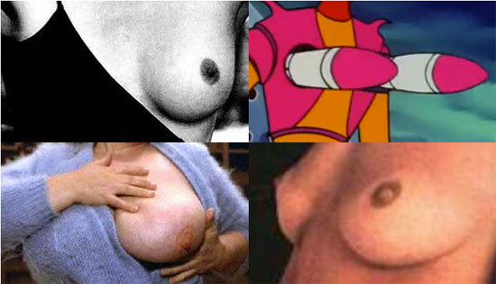 tetas3