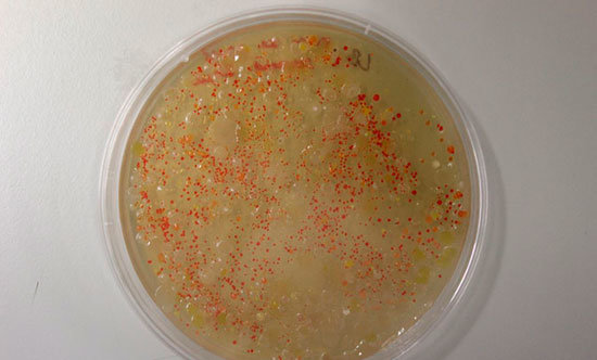 bacterias-2