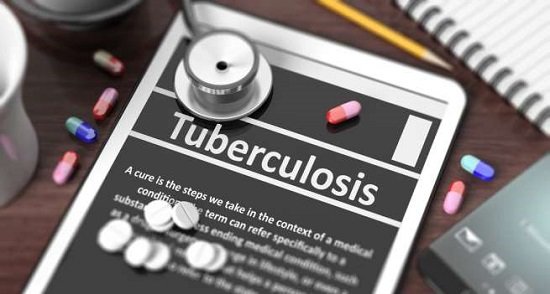 tuberculosis